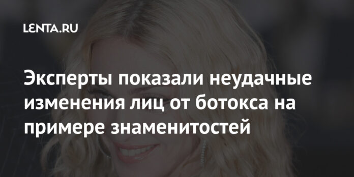 Эксперты показали неудачные изменения лиц от ботокса на примере знаменитостей: Внешний вид: Ценности: Lenta.ru