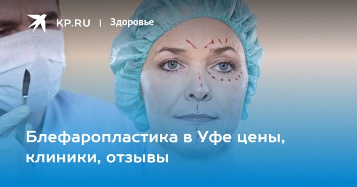 Блефаропластика в Уфе цены, клиники, отзывы