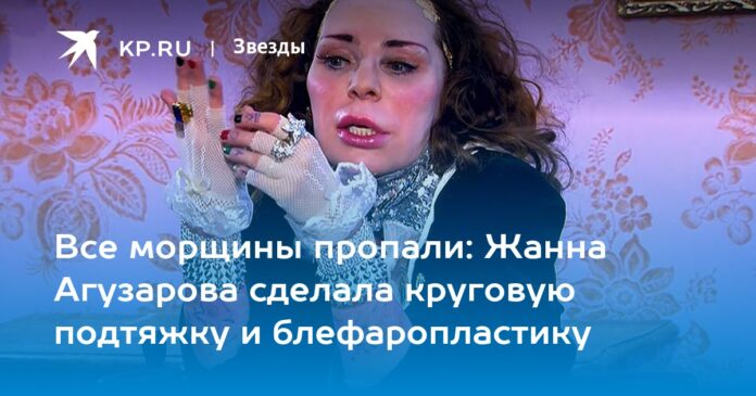 Жанна Агузарова сделала круговую подтяжку и блефаропластику