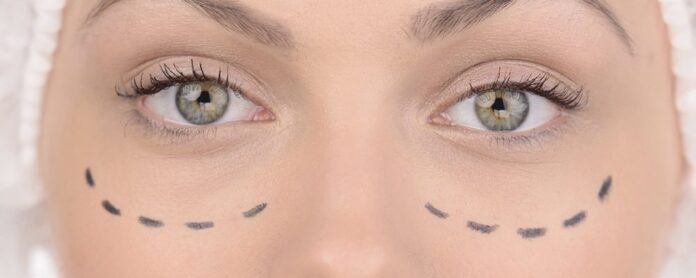 Кантопексия: показания, техники проведения, риски - Интернет-журнал «PRO Здоровье» - PRO Здоровье