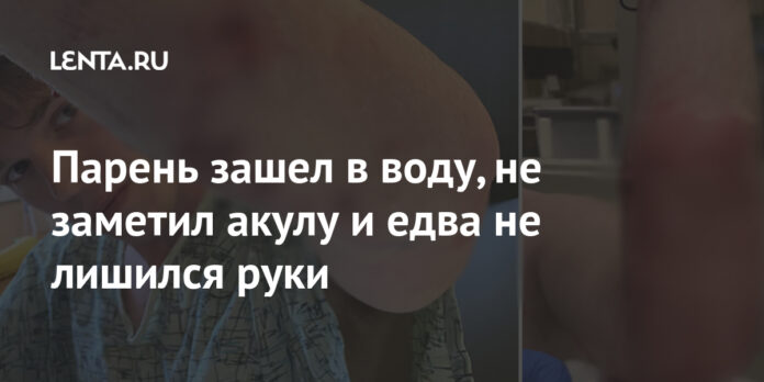 Парень зашел в воду, не заметил акулу и едва не лишился руки: Звери: Из жизни: Lenta.ru