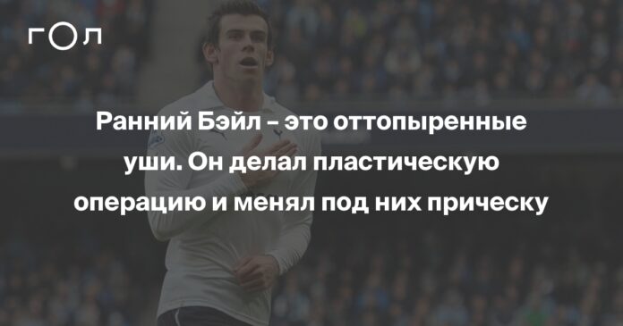 Ранний Бэйл – это оттопыренные уши. Он делал пластическую операцию и менял под них прическу