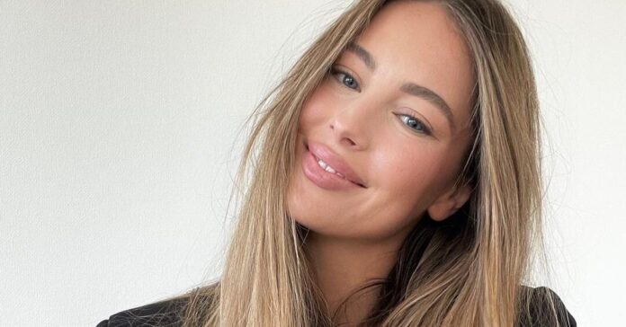 Удивительные побочные эффекты: вся правда о ботоксе | Журнал GRAZIA - Grazia