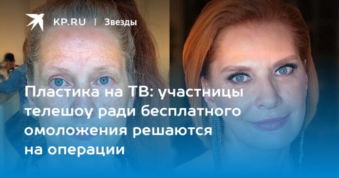 участницы телешоу ради бесплатного омоложения решаются на операции