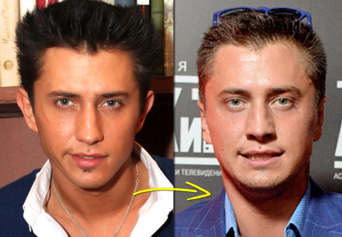 Звезды, которые делали пластику ушей