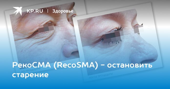 РекоСМА (RecoSMA) - остановить старение