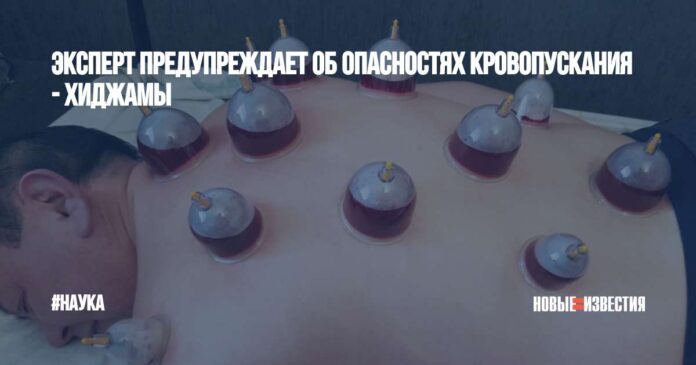 Эксперт предупреждает об опасностях кровопускания - хиджамы - Новые Известия