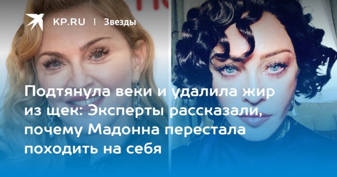 Эксперты рассказали, почему Мадонна перестала походить на себя