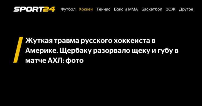 Жуткая травма русского хоккеиста в Америке. Щербаку разорвало щеку и губу в матче АХЛ: фото - 11 апреля 2021