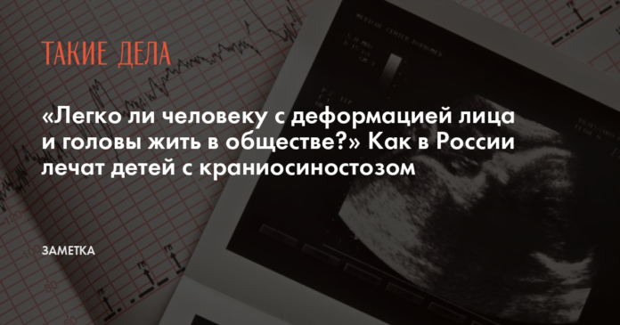 «Легко ли человеку с деформацией лица и головы жить в обществе?» Как в России лечат детей с краниосиностозом