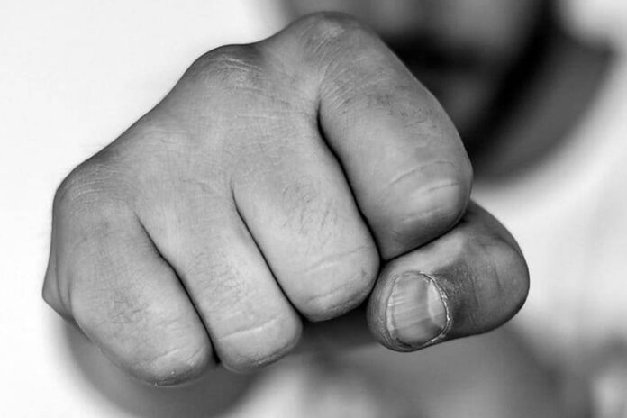 Минчанин после спора с незнакомцем в баре оказался в больнице