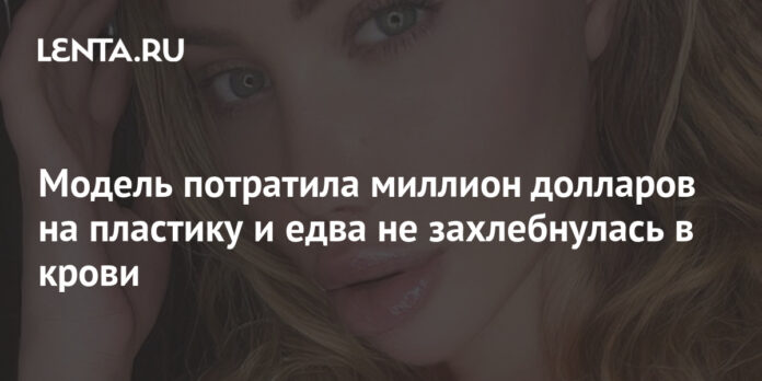 Модель потратила миллион долларов на пластику и едва не захлебнулась в крови: Внешний вид: Ценности: Lenta.ru