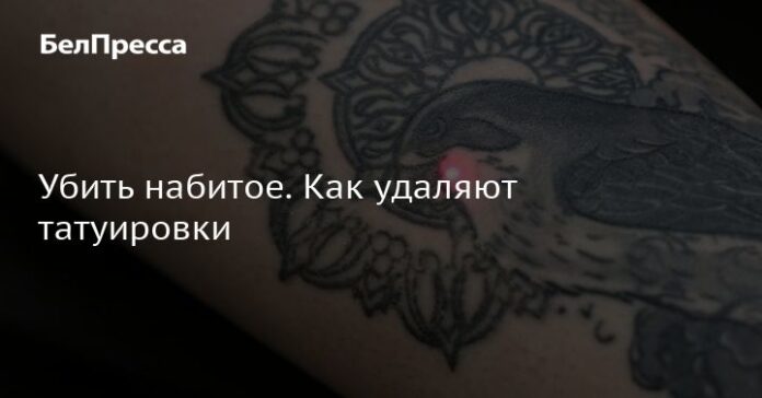 Убить набитое. Как удаляют татуировки. Новости общества